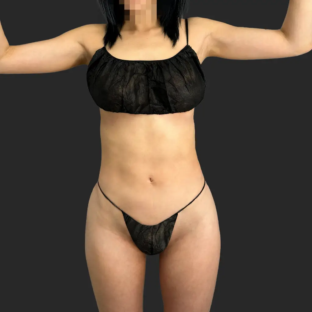 Before image