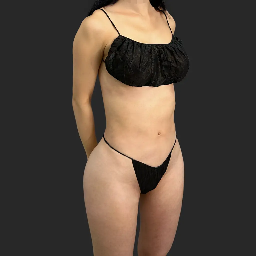 Additional before image