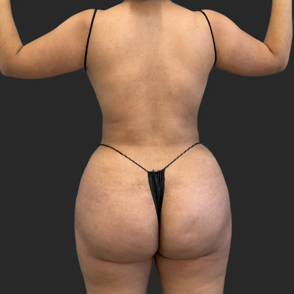 After image