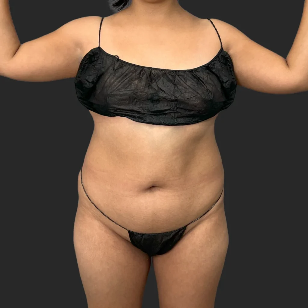 Additional before image