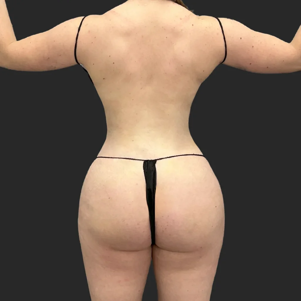 After image