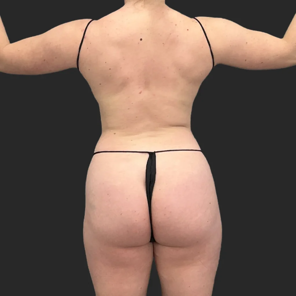 Before image