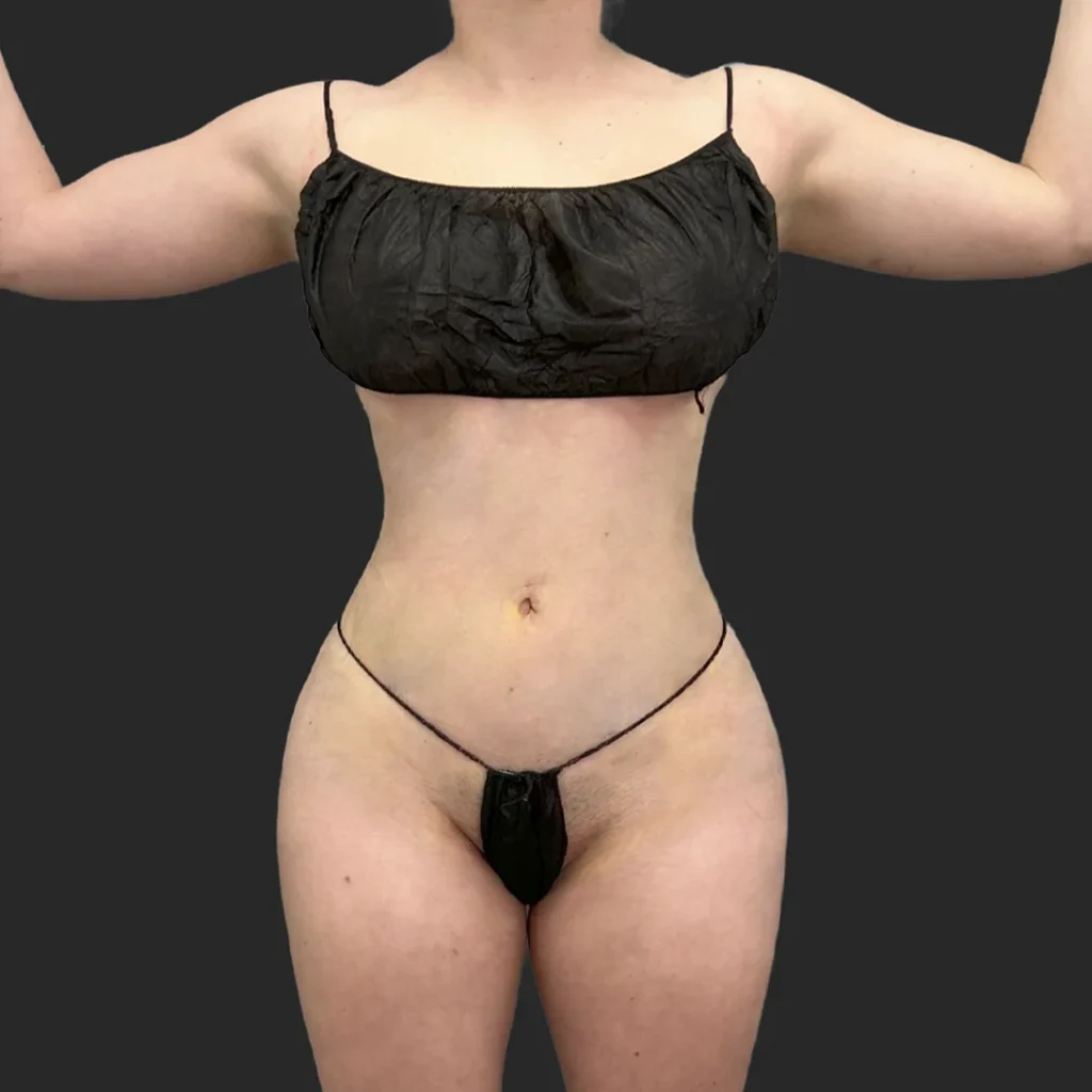 Additional after image