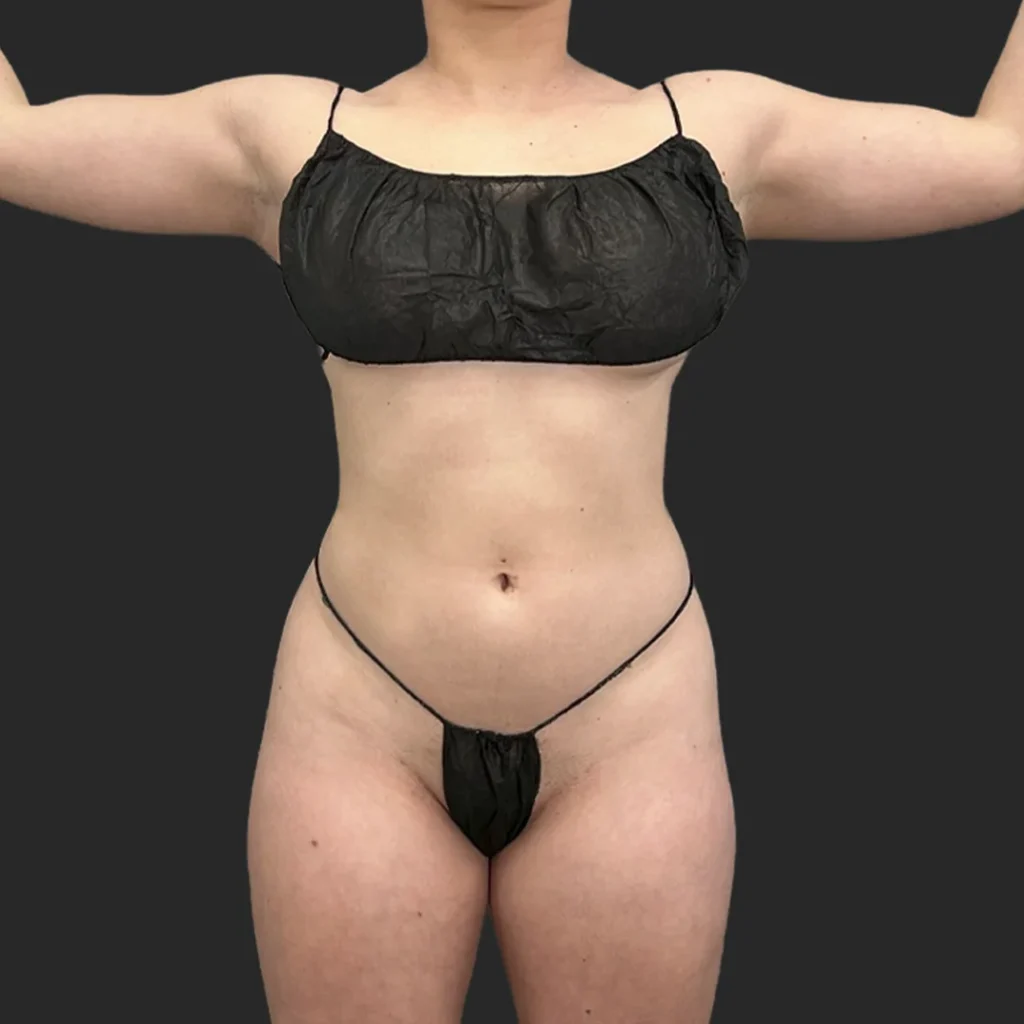 Additional before image