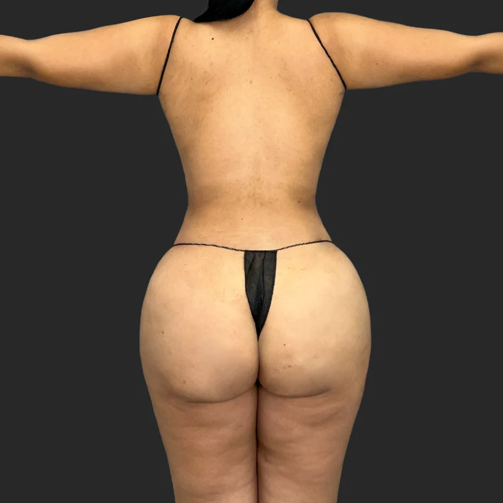 After image