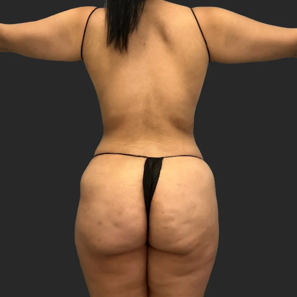 Before image