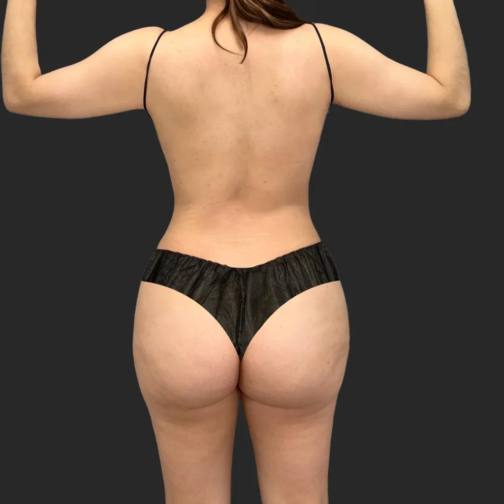After image