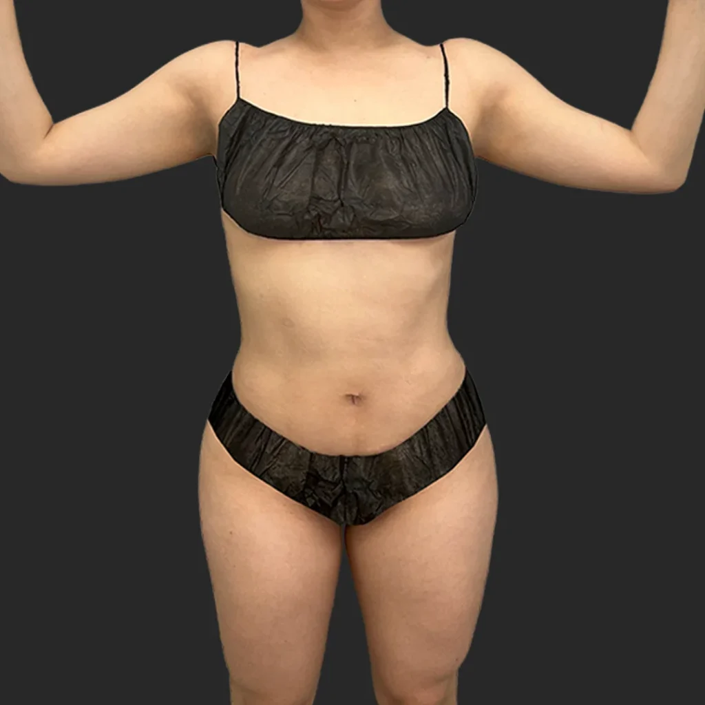 Additional after image