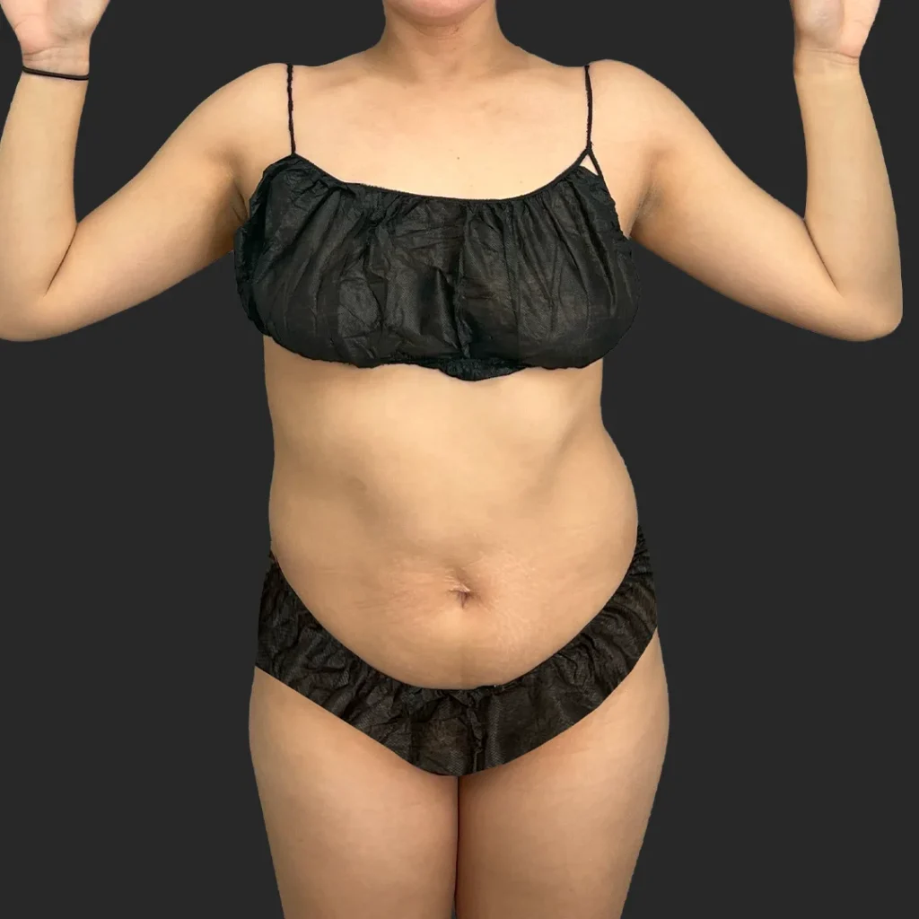 Additional before image
