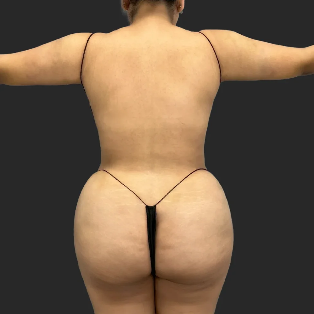 After image
