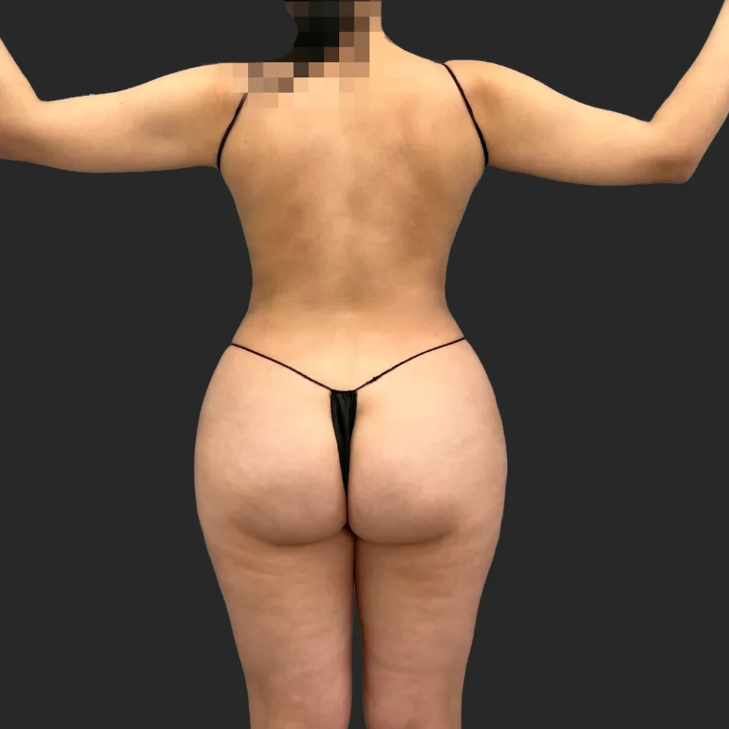 After image