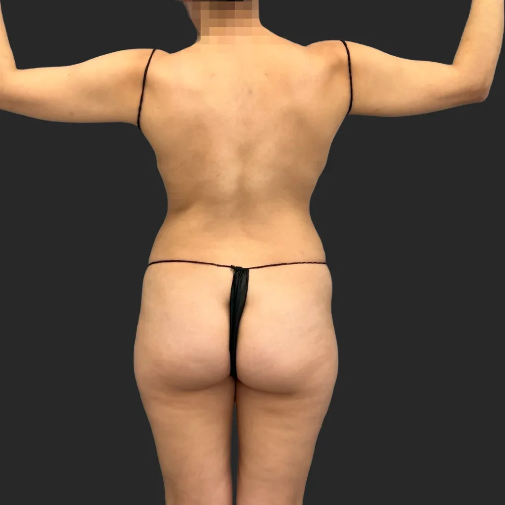 Before image