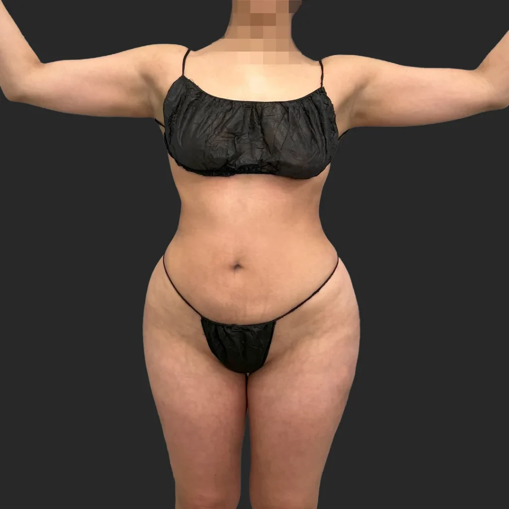 Additional after image