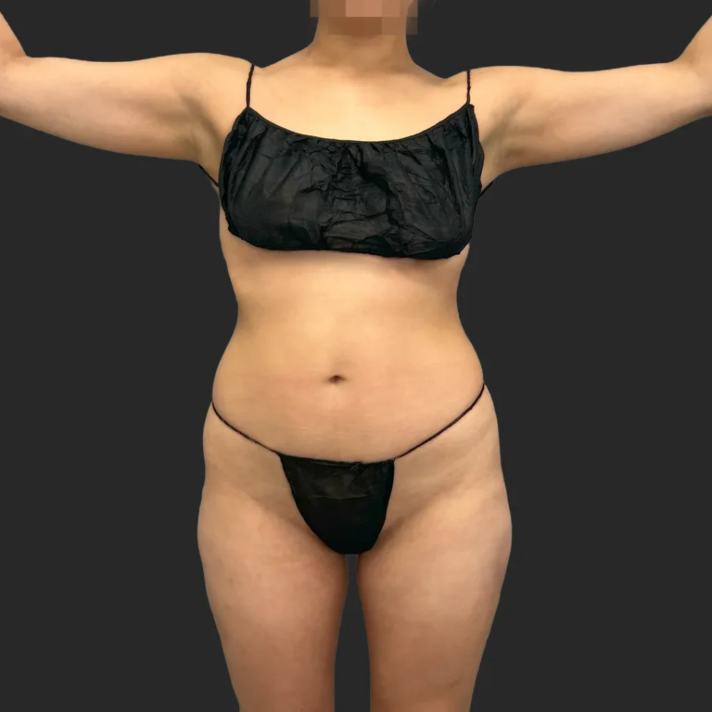 Additional before image
