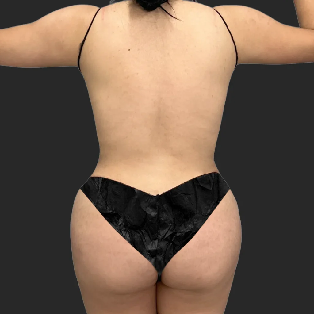 After image
