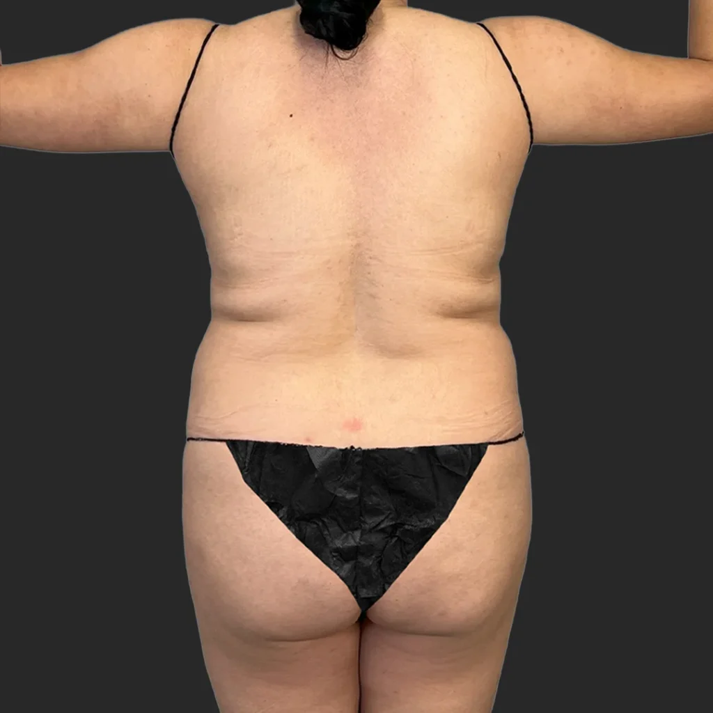 Before image