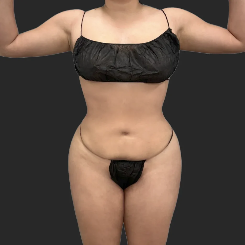 Additional after image