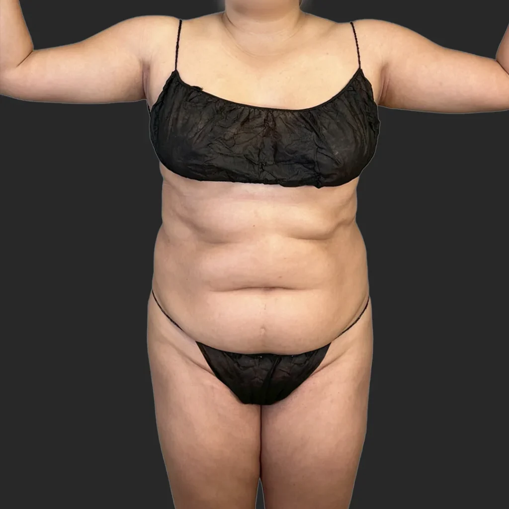 Additional before image