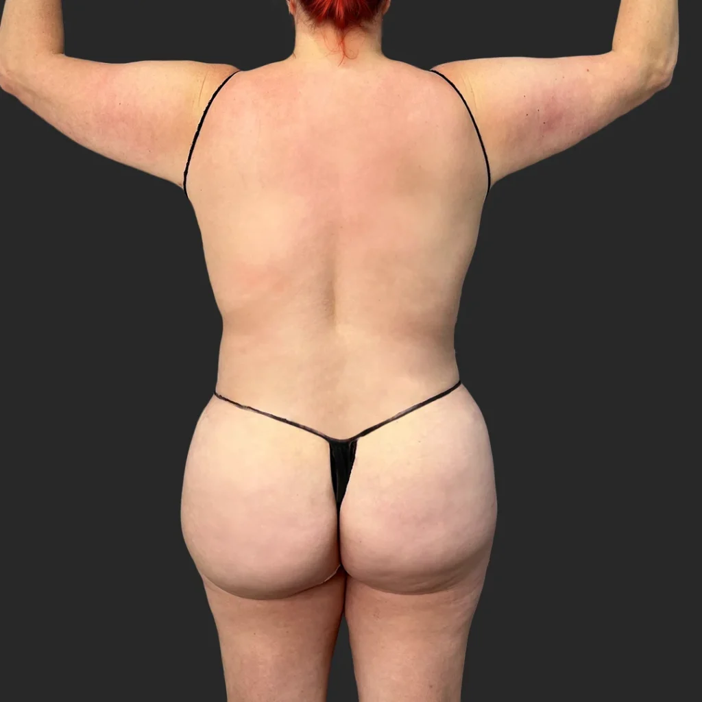After image