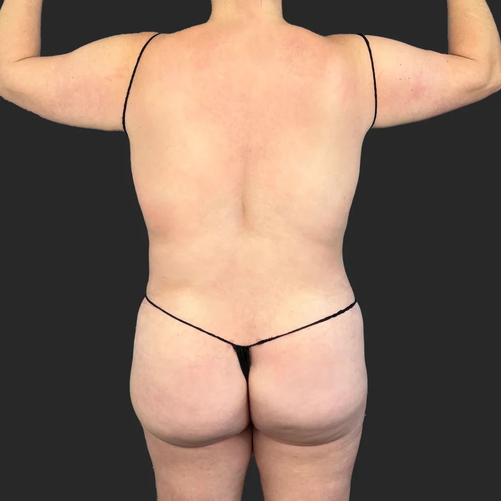 Before image