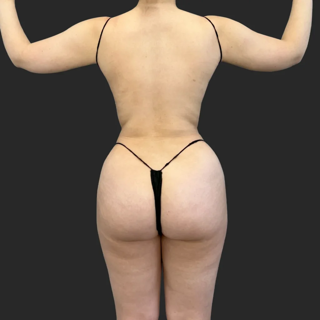 After image