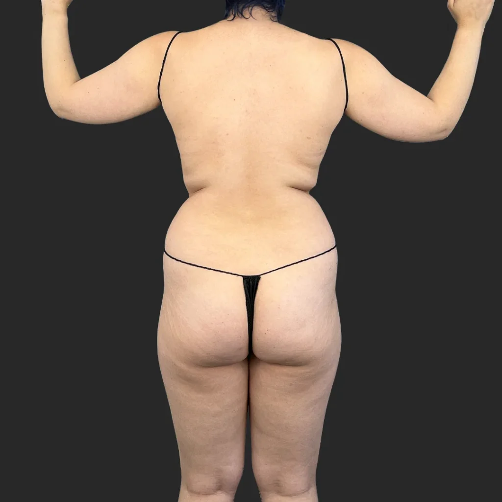 Before image