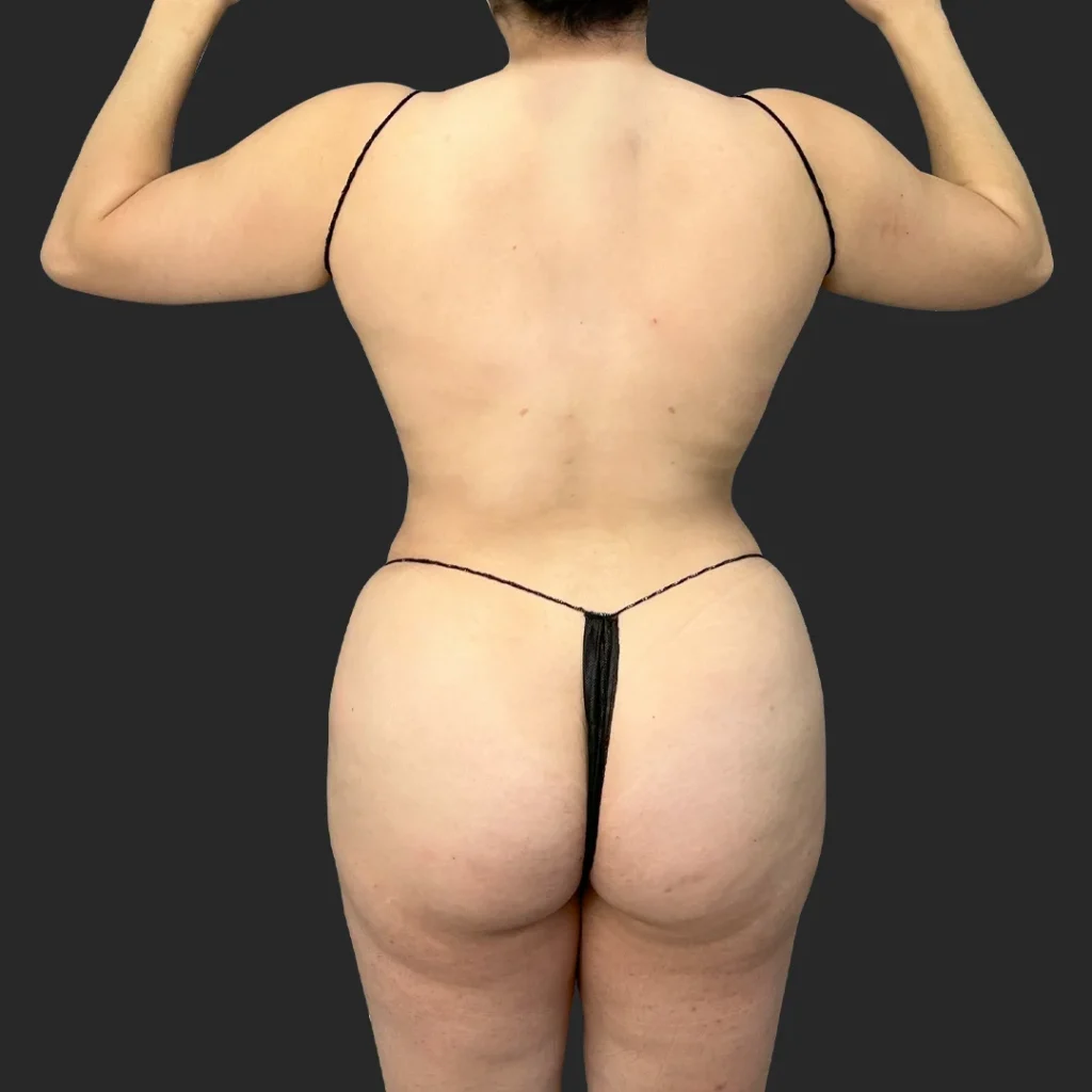 After image