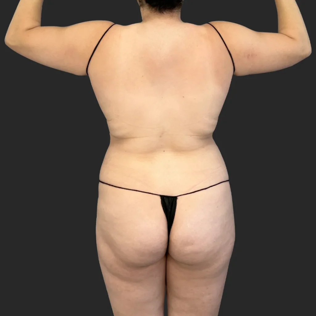 Before image