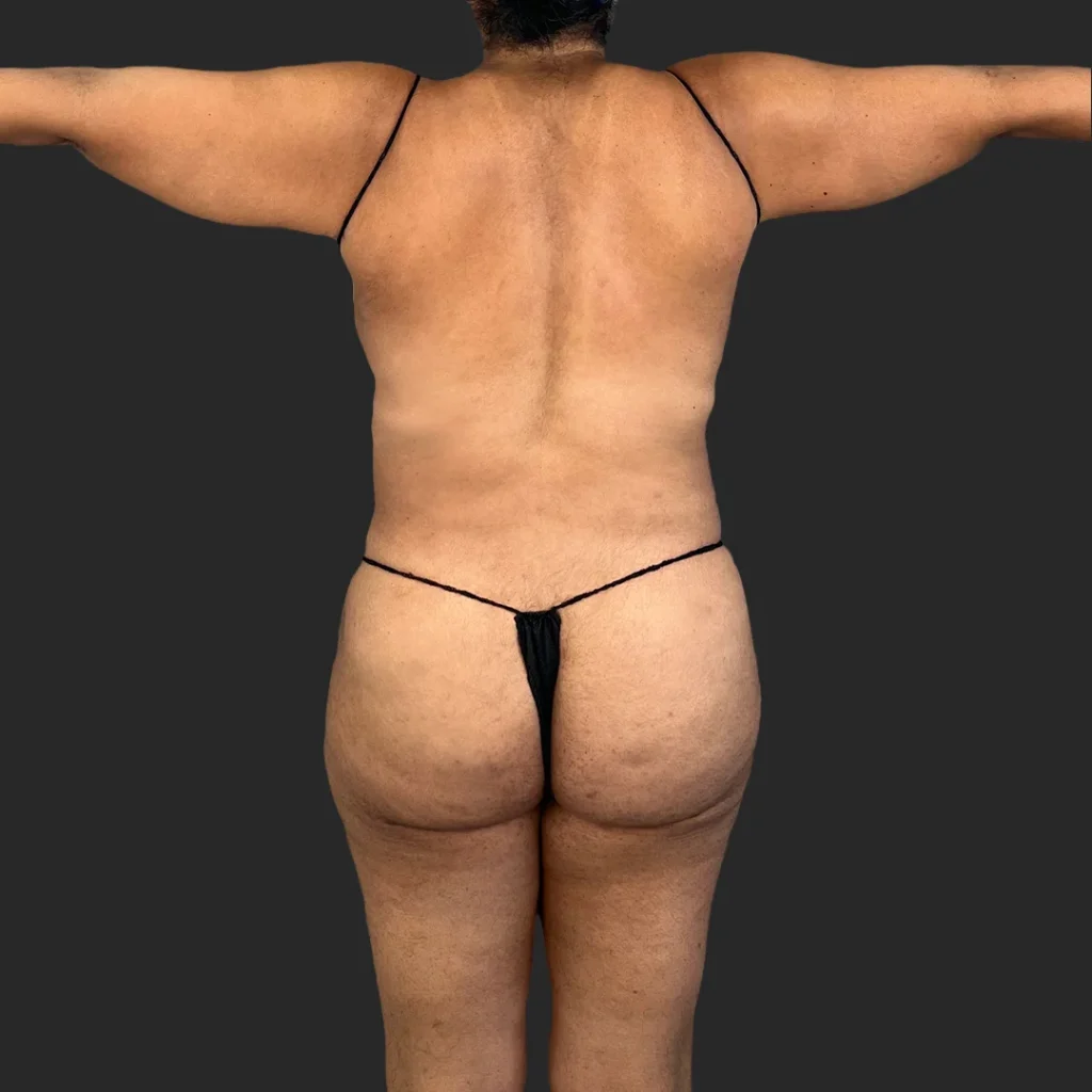 After image