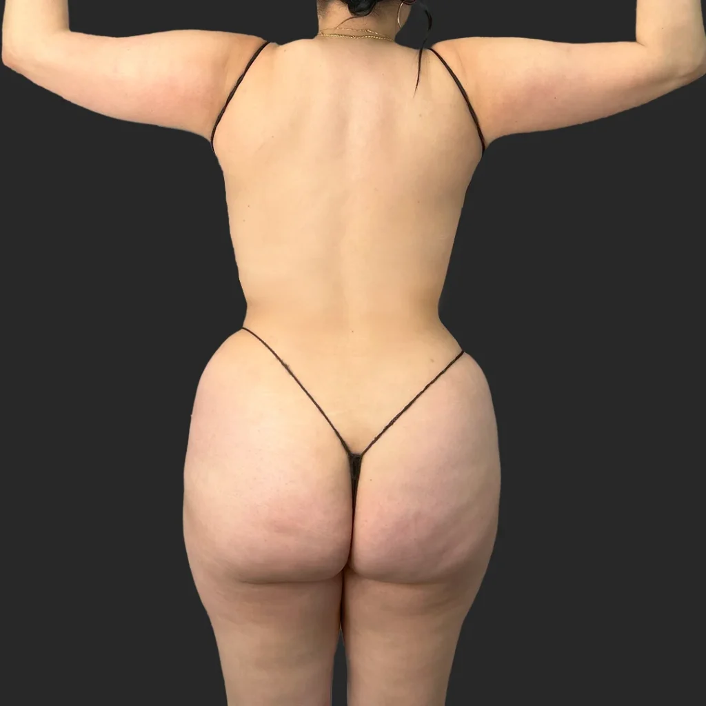 After image