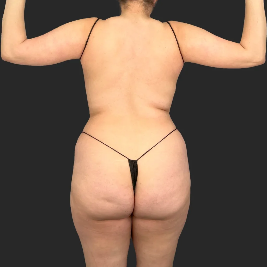 Before image