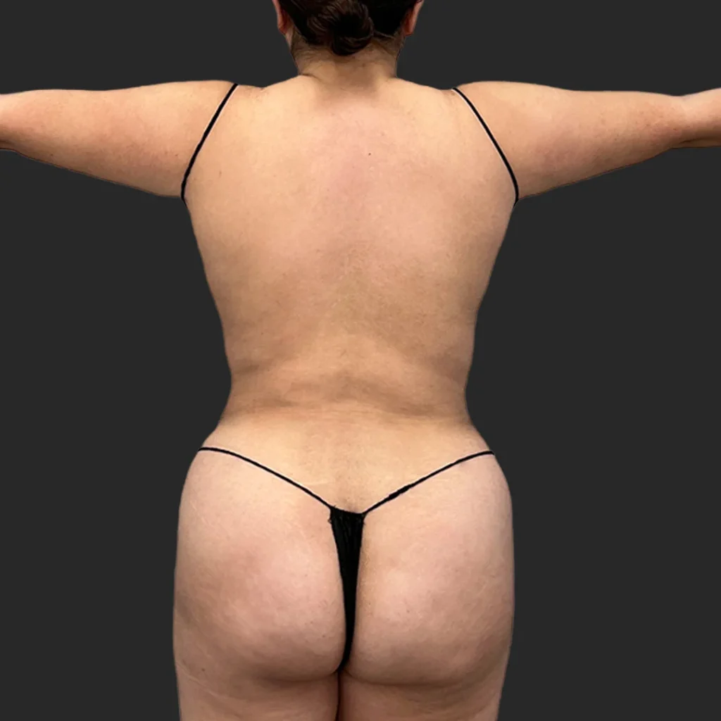 After image