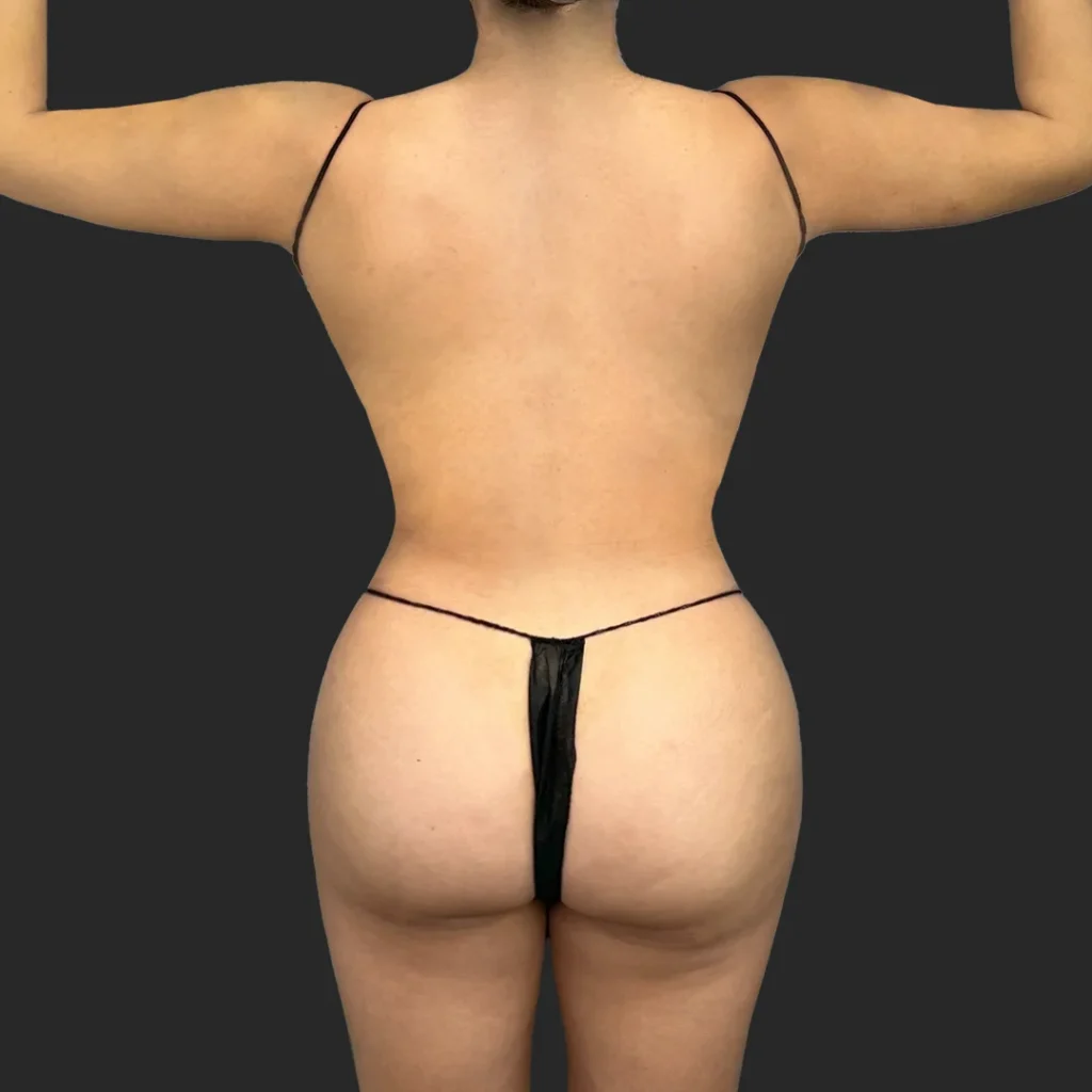 After image