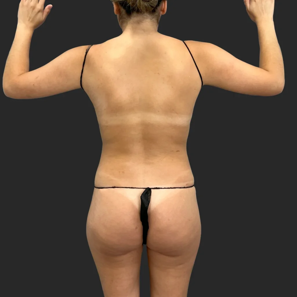 Before image