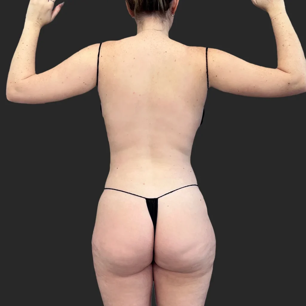 Before image
