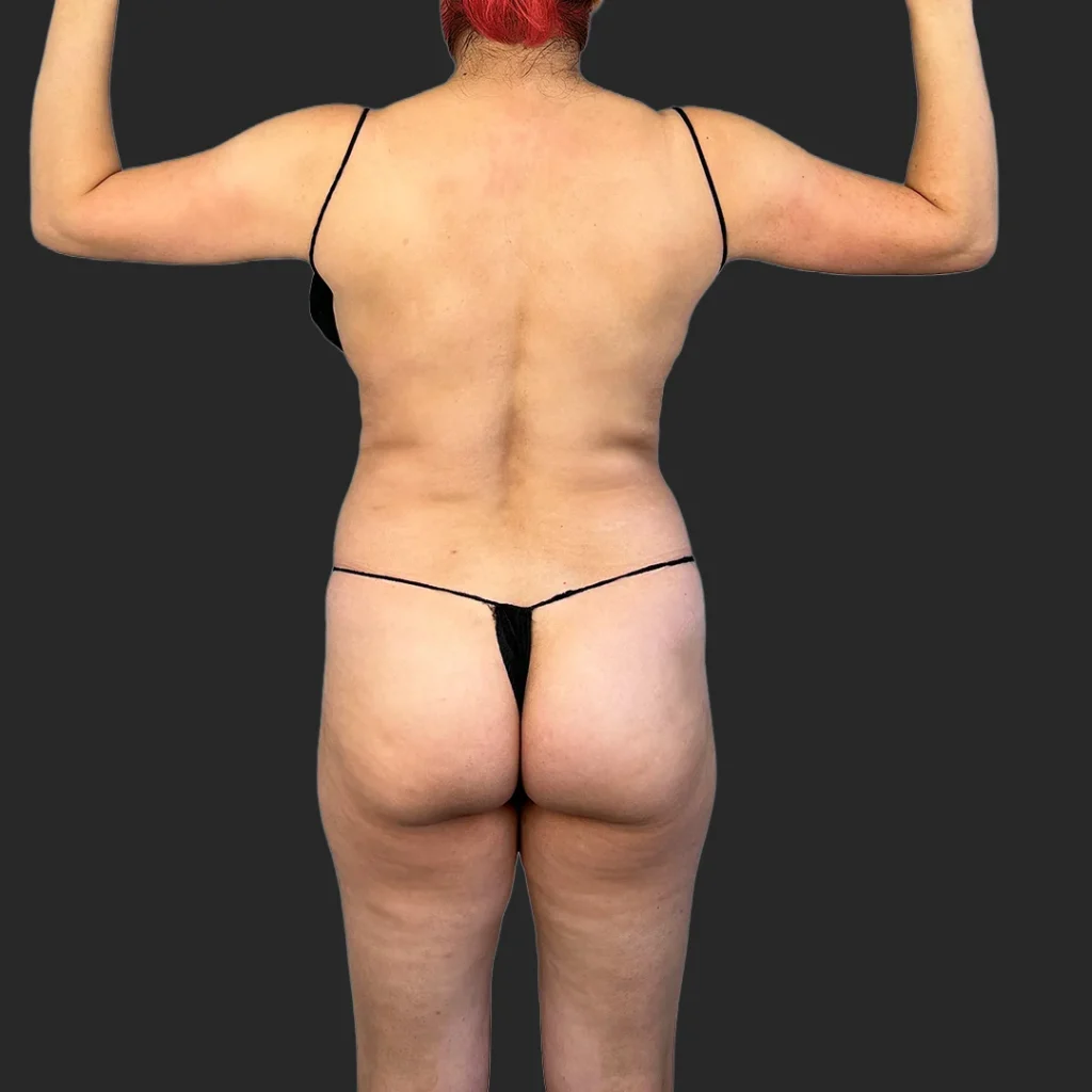 Before image