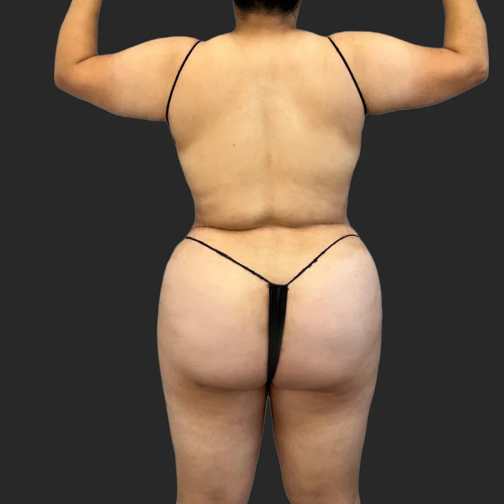 After image