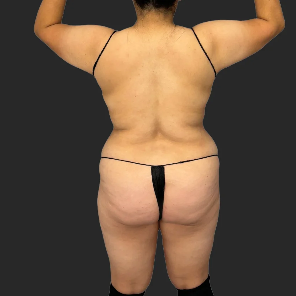 Before image