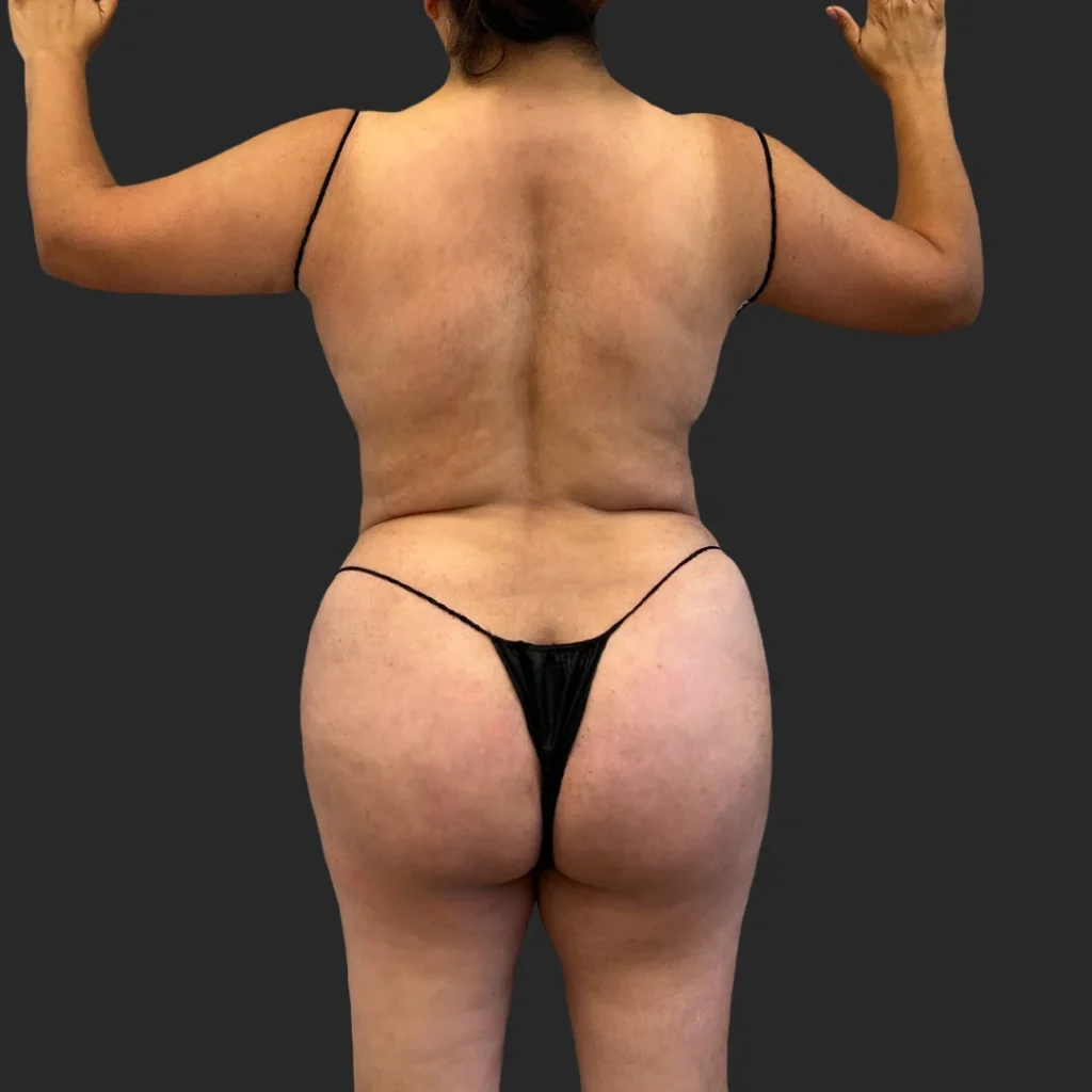 After image