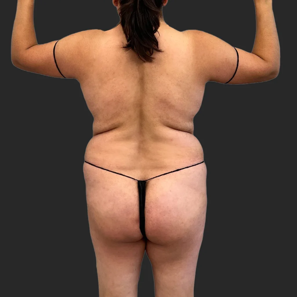Before image