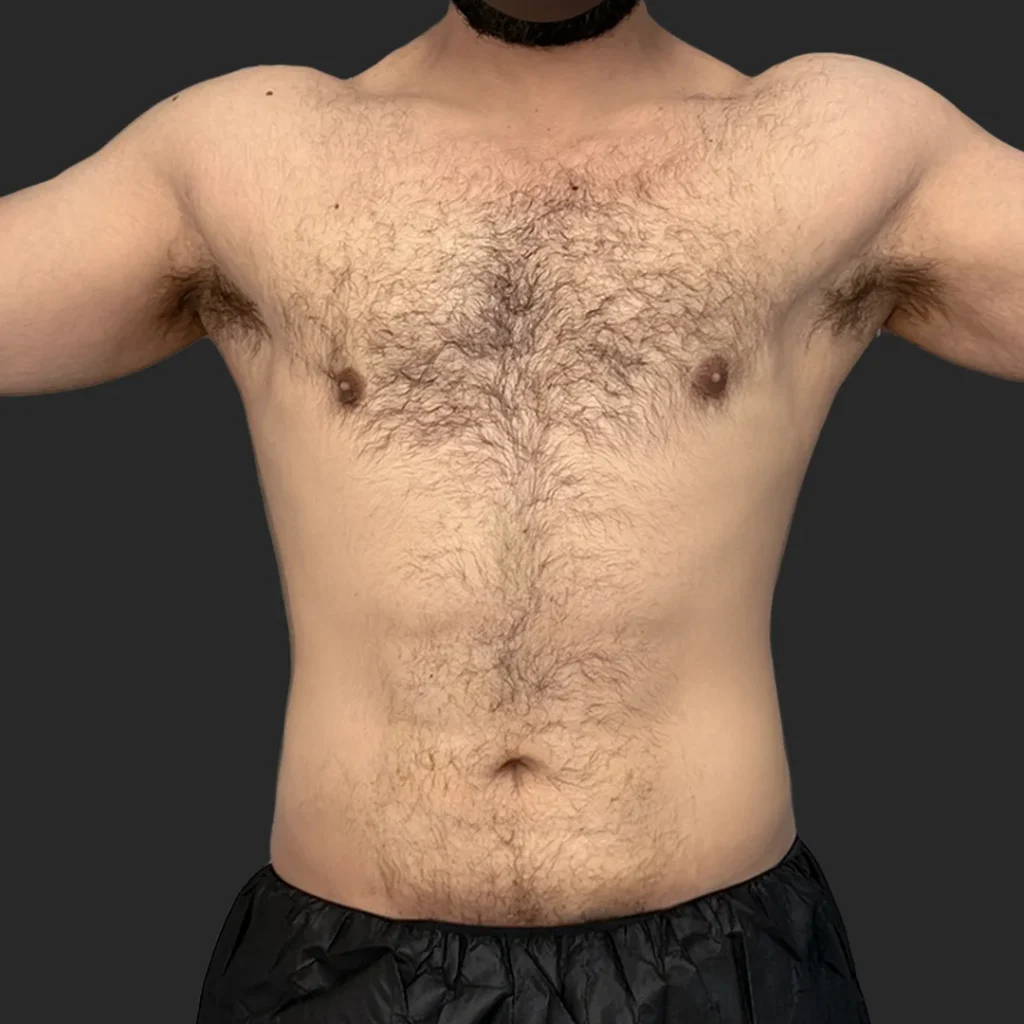 After image