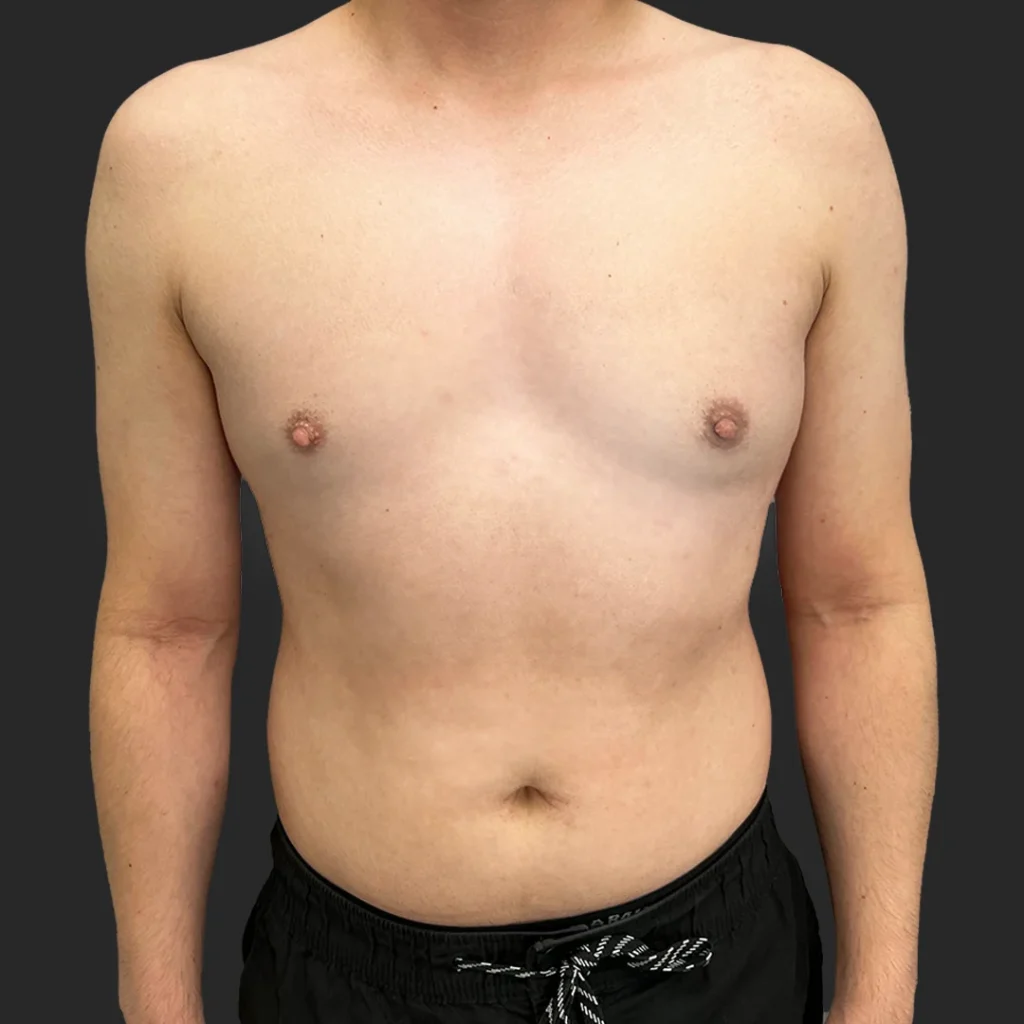 After image