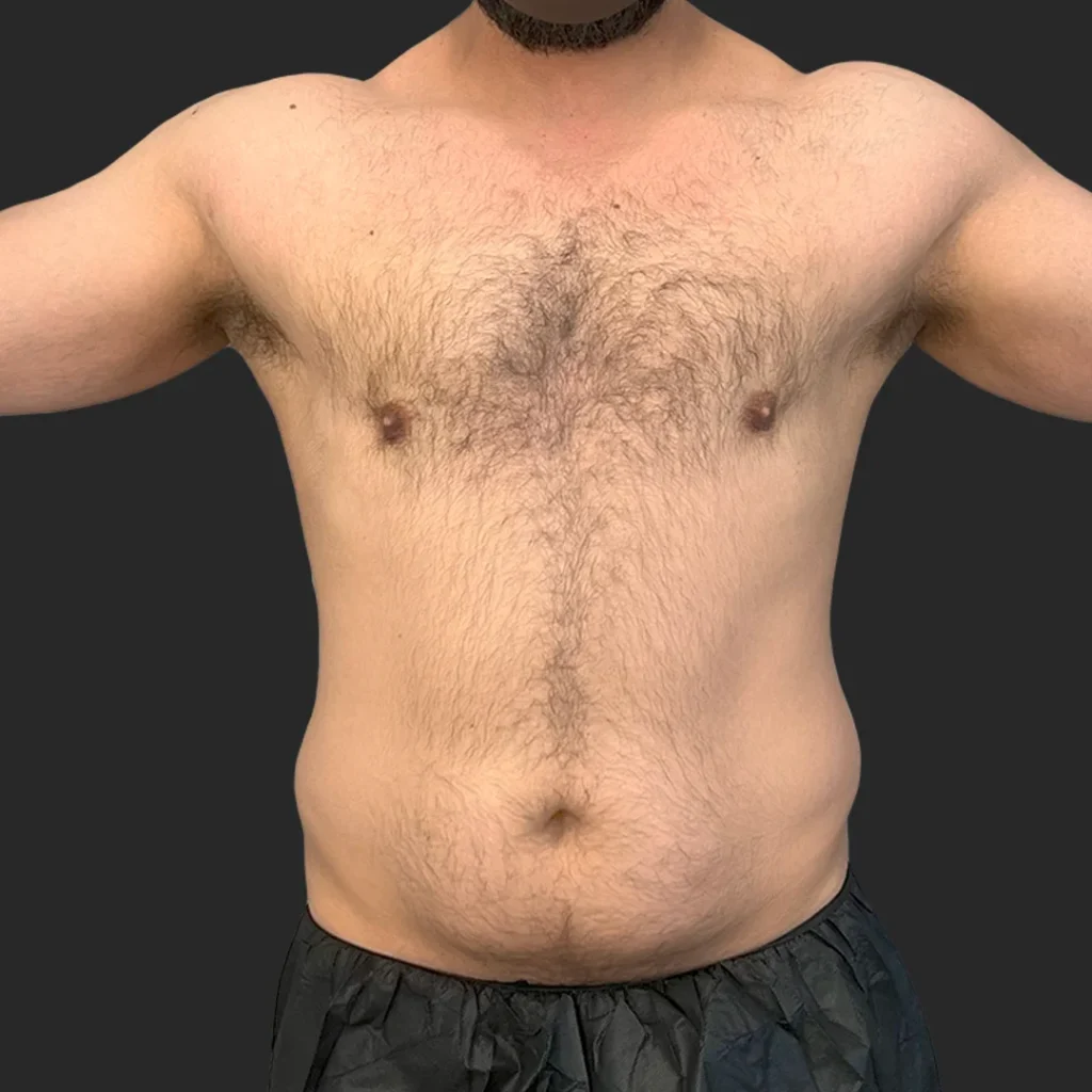 Before image