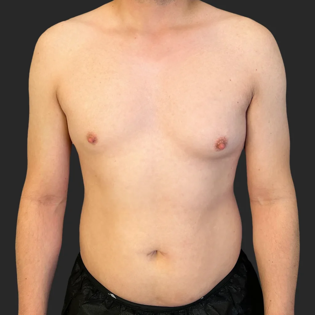 Before image