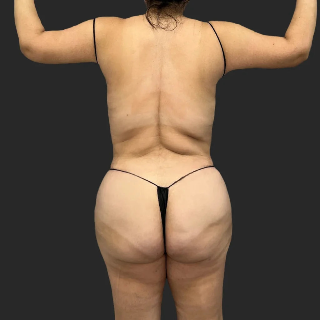 After image