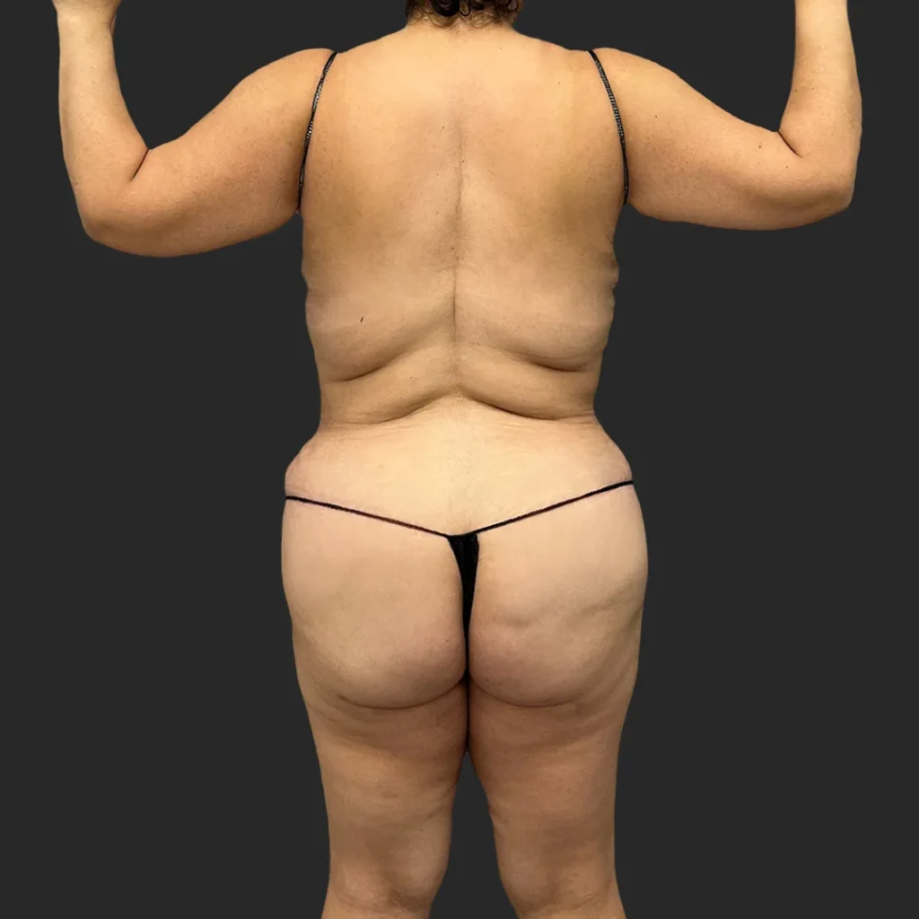 Before image