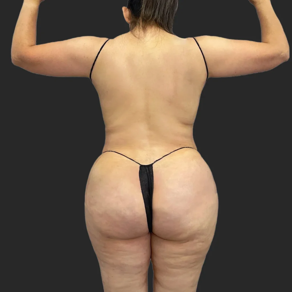 After image