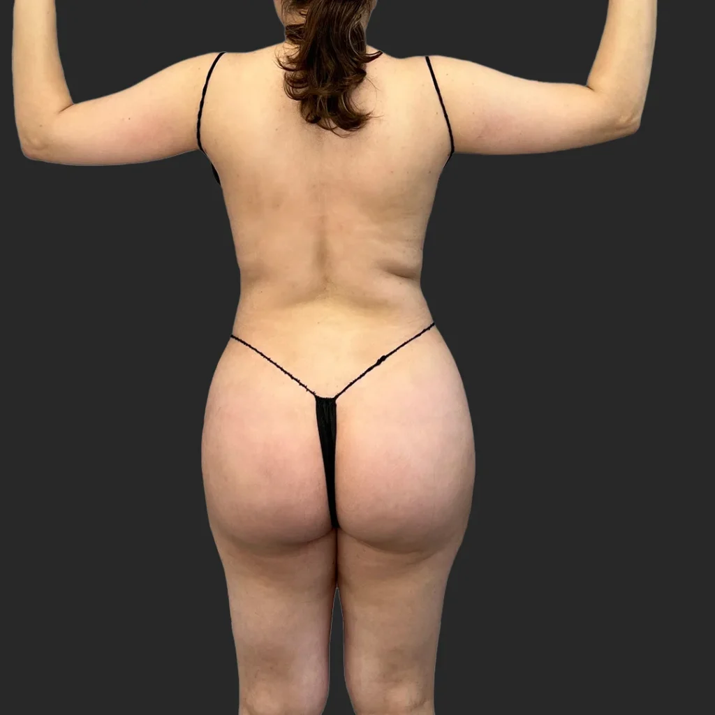 After image