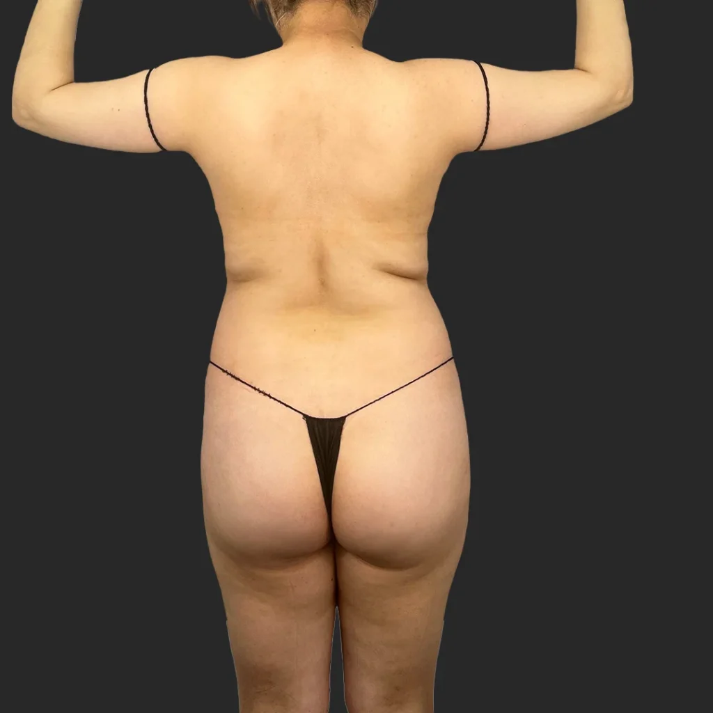 Before image