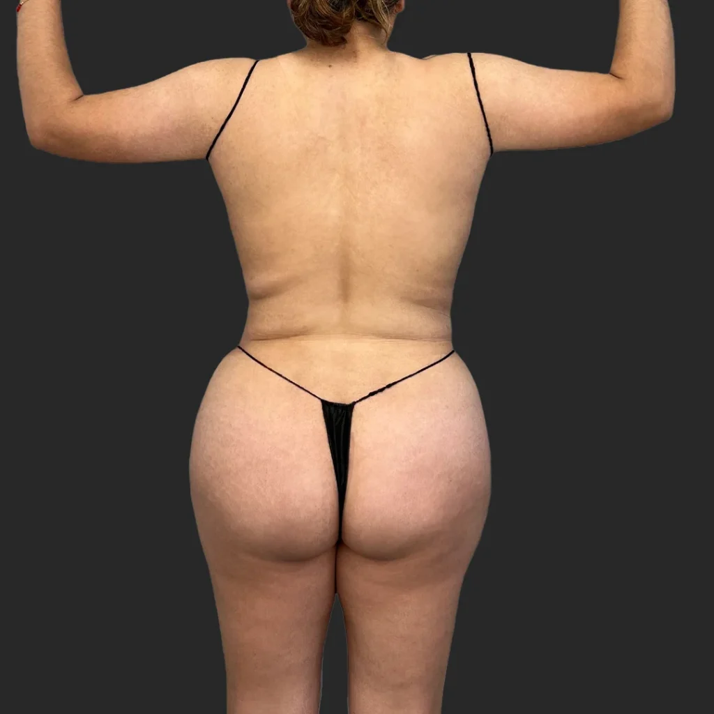 After image